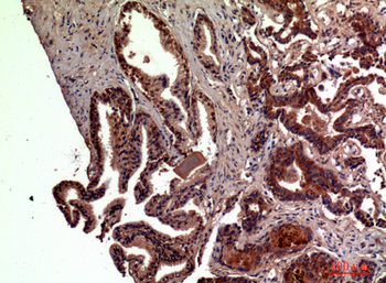 RSAD2 Polyclonal Antibody