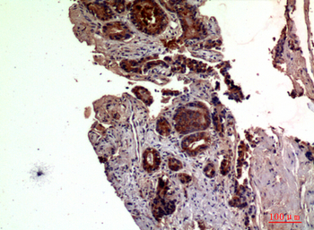 RSAD2 Polyclonal Antibody
