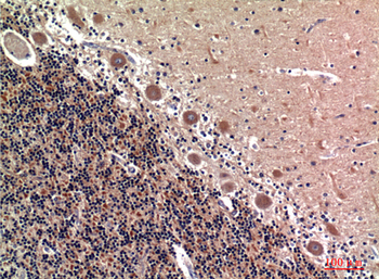 RSAD2 Polyclonal Antibody