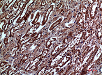 IGFBP3 Polyclonal Antibody
