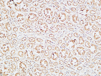 IGFBP3 Polyclonal Antibody