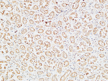 IGFBP3 Polyclonal Antibody