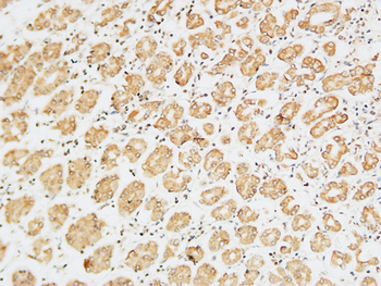 TERT Polyclonal Antibody