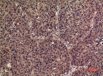 IL-1F8 Polyclonal Antibody