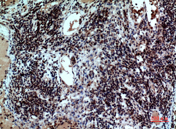 CD47 Polyclonal Antibody