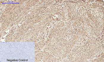 HMG-1 Polyclonal Antibody