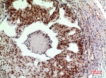 SRY Polyclonal Antibody