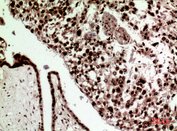 SRY Polyclonal Antibody