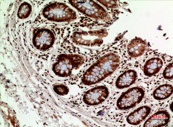 HLA-DQB1/2 Polyclonal Antibody