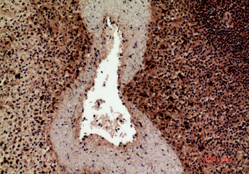 HLA-DQB1/2 Polyclonal Antibody