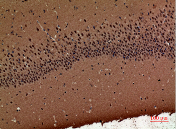 POLR3G Polyclonal Antibody
