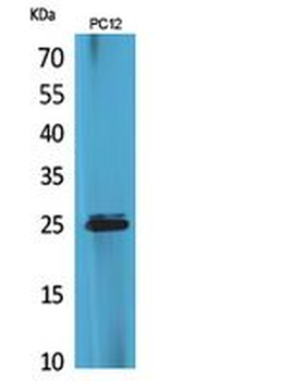 CMTM5 Polyclonal Antibody