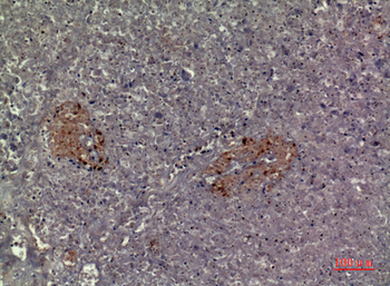 CMTM5 Polyclonal Antibody