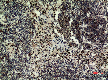 HRP-3 Polyclonal Antibody