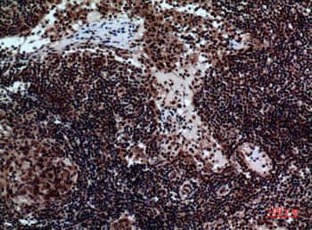 NKp44 Polyclonal Antibody
