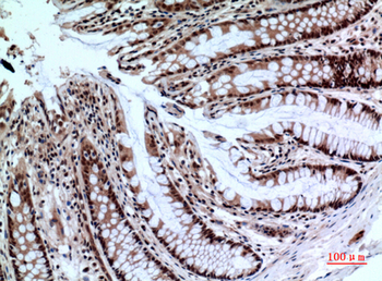 NKp44 Polyclonal Antibody