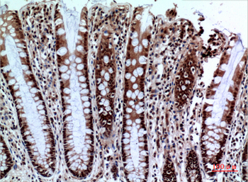 NKp44 Polyclonal Antibody