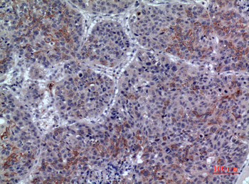 LIR-6 Polyclonal Antibody