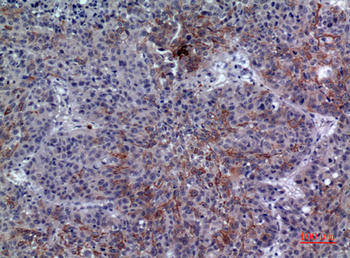 LIR-6 Polyclonal Antibody