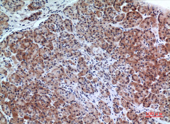 LIR-6 Polyclonal Antibody