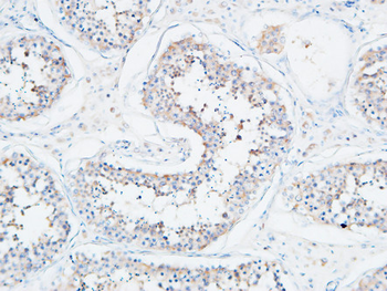 SERCA2 Polyclonal Antibody