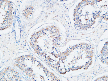 SERCA2 Polyclonal Antibody