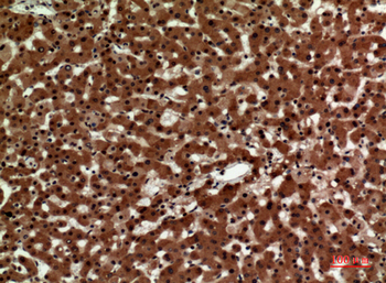 IL-12A p35 Polyclonal Antibody
