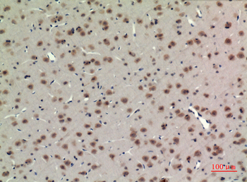 BMAL1 Polyclonal Antibody