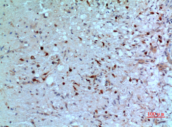 PD-ECGF Polyclonal Antibody