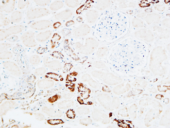 PD-ECGF Polyclonal Antibody