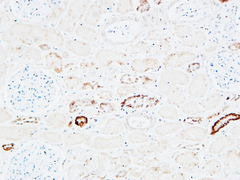 PD-ECGF Polyclonal Antibody