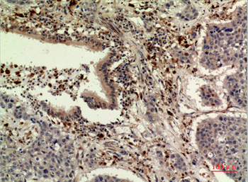TPO Polyclonal Antibody