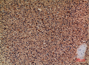 Cerberus Polyclonal Antibody