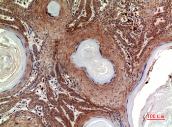 Inhibin β-B Polyclonal Antibody