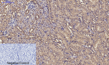 RANKL Polyclonal Antibody