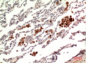 RANKL Polyclonal Antibody