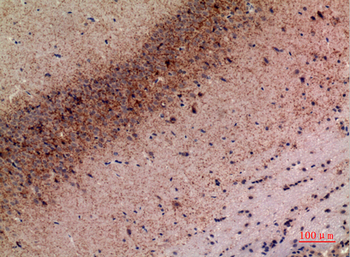 Endo180 Polyclonal Antibody