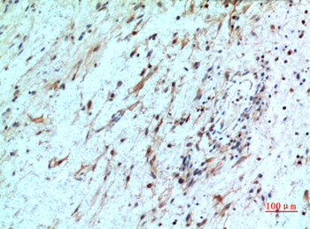 IL-8Rβ Polyclonal Antibody