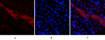 CD81 Polyclonal Antibody