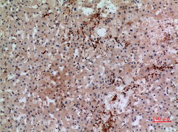CD42b Polyclonal Antibody