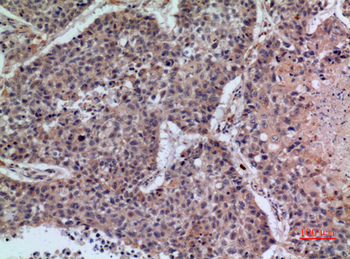 CD42b Polyclonal Antibody
