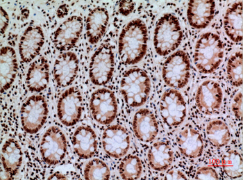 CacyBP Polyclonal Antibody