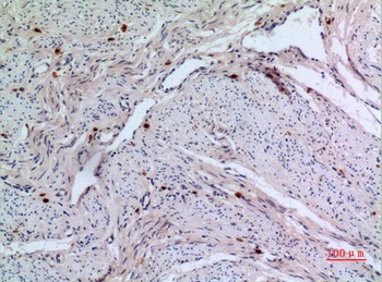 RFC1 Polyclonal Antibody