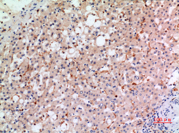 gp91-phox Polyclonal Antibody