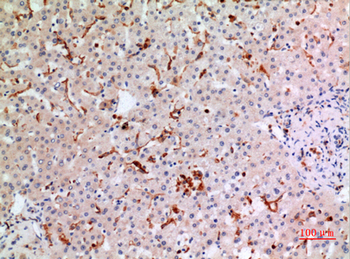 gp91-phox Polyclonal Antibody