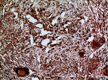 Laminin γ-2 Polyclonal Antibody