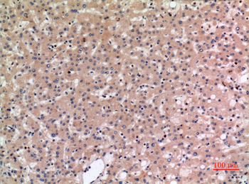 NTCP Polyclonal Antibody