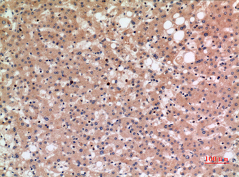 NTCP Polyclonal Antibody