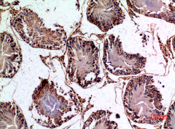 NTE Polyclonal Antibody