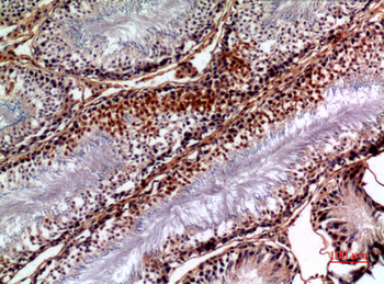 NTE Polyclonal Antibody